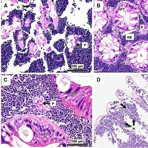 网络新型病毒XX病毒迅速传播,千万用户感染警告