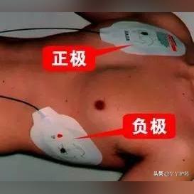 『心肺复苏最新标准解读，掌握关键操作细节』